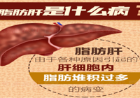 【健康科普】太阳集团网站1088vip感染科：远离脂肪肝，健康好生活
