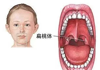 【健康科普】儿童扁桃体、腺样体肿大，要手术吗？